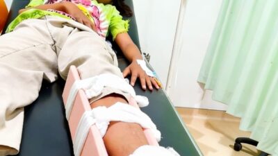 Keluarga Tuntut Pertanggung Jawaban Penuh,Anak Patah kaki Akibat Kecelakan Lalu lintas.