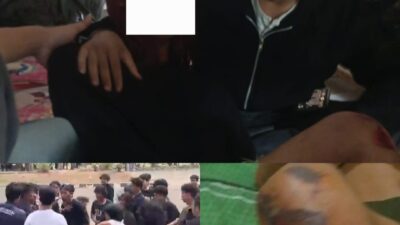 Keluar dari GSG, Mahasiswa FP Unila Diduga Dikeroyok: Korban Lapor Polisi